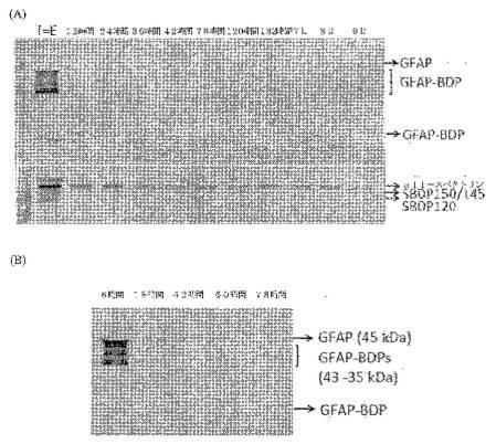 2016105097-ニューロン損傷診断のためのマイクロＲＮＡ、自己抗体およびタンパク質マーカー 図000038