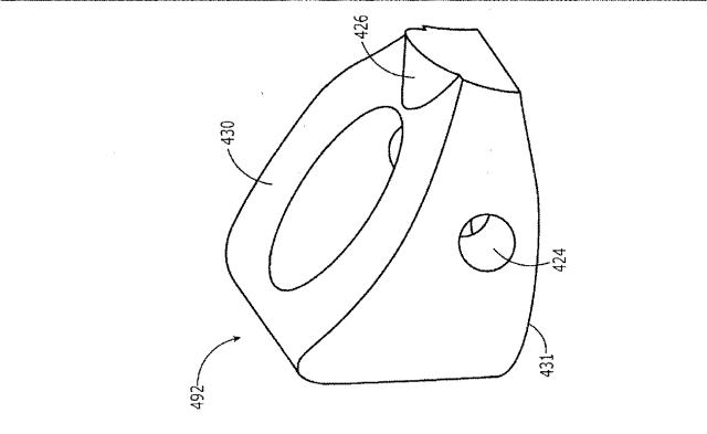 2018187457-髄内転子間固定インプラント用の一方向摺動装置 図000038