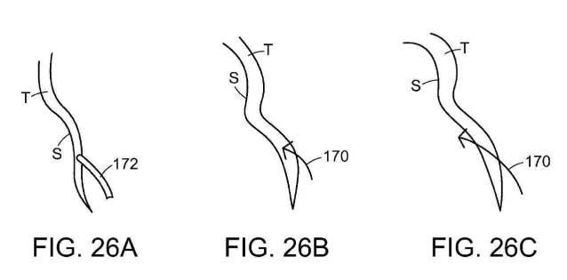 2019022777-心臓弁置換のためのデバイス、システムおよび方法 図000038