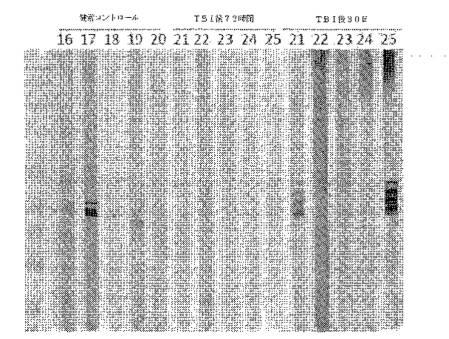 2016105097-ニューロン損傷診断のためのマイクロＲＮＡ、自己抗体およびタンパク質マーカー 図000040
