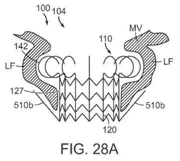 2019022777-心臓弁置換のためのデバイス、システムおよび方法 図000040