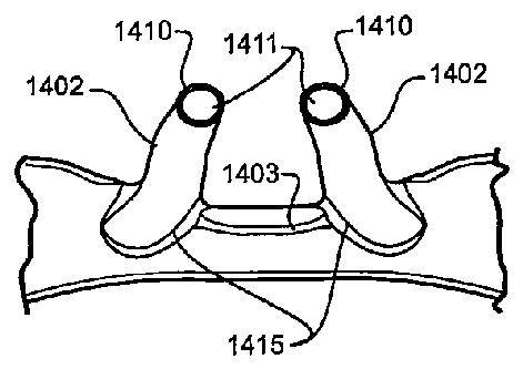 2019213869-鼻カニューレ、導管及び固定システム 図000040