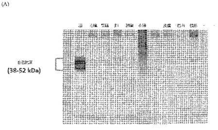 2016105097-ニューロン損傷診断のためのマイクロＲＮＡ、自己抗体およびタンパク質マーカー 図000042