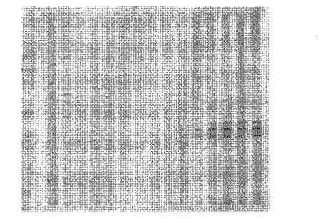 2016105097-ニューロン損傷診断のためのマイクロＲＮＡ、自己抗体およびタンパク質マーカー 図000043