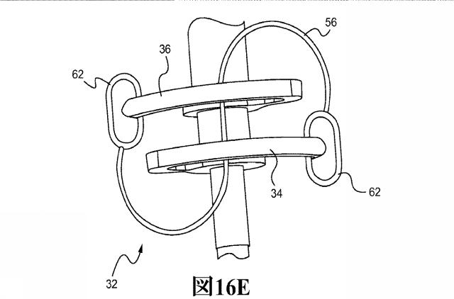 2017200593-回転針を用いた皮膚縫合装置 図000043