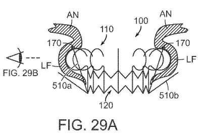 2019022777-心臓弁置換のためのデバイス、システムおよび方法 図000043