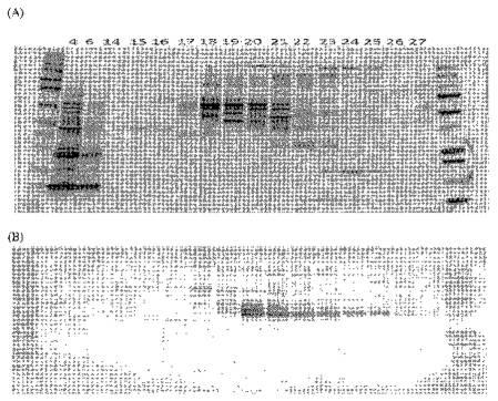 2016105097-ニューロン損傷診断のためのマイクロＲＮＡ、自己抗体およびタンパク質マーカー 図000045