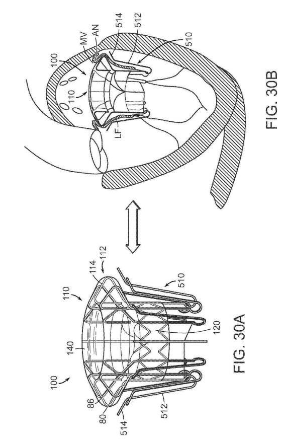 2019022777-心臓弁置換のためのデバイス、システムおよび方法 図000045