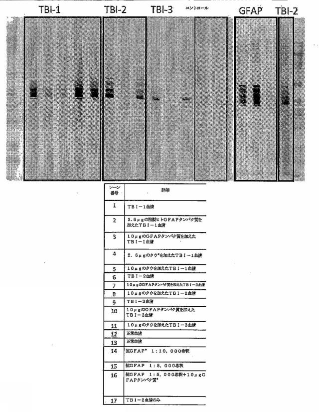 2016105097-ニューロン損傷診断のためのマイクロＲＮＡ、自己抗体およびタンパク質マーカー 図000046