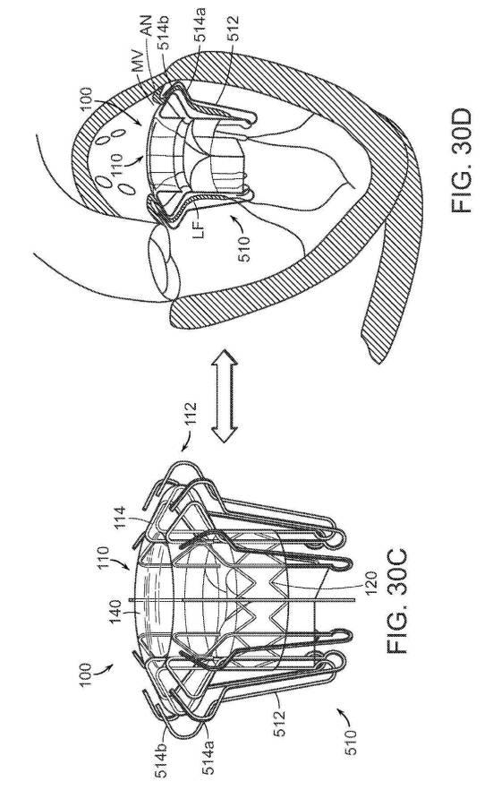 2019022777-心臓弁置換のためのデバイス、システムおよび方法 図000046