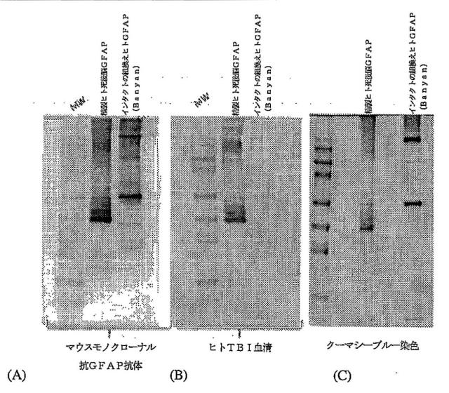 2016105097-ニューロン損傷診断のためのマイクロＲＮＡ、自己抗体およびタンパク質マーカー 図000047