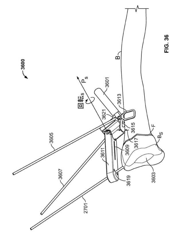 2018114305-骨修復準備のための装置および方法 図000049