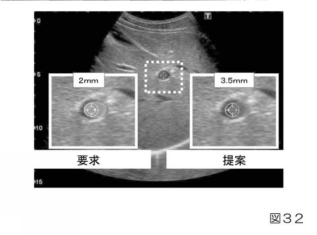 2019033960-生体内運動追跡装置、生体内運動追跡方法およびプログラム 図000049