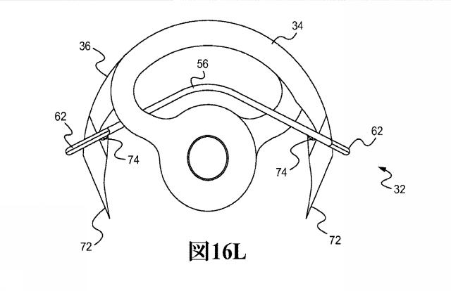 2017200593-回転針を用いた皮膚縫合装置 図000050