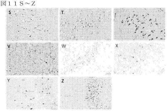 2019022500-ＴＤＰ−４３に特異的な結合分子 図000053