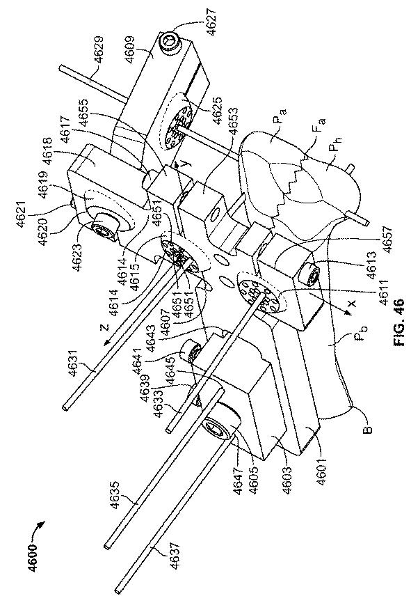 2018114305-骨修復準備のための装置および方法 図000059