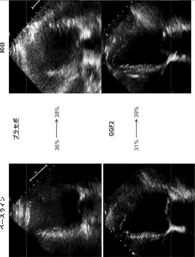 2019194208-心不全の治療または予防のためのニューレグリンまたはその断片の治療的投与の方法 図000061