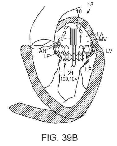 2019022777-心臓弁置換のためのデバイス、システムおよび方法 図000064