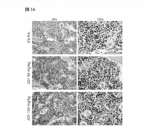 2016102105-白血病を治療するための組成物および方法 図000088