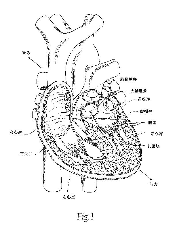 5647680-一体的な迅速接続人工心臓弁ならびに配備のシステムおよび方法 図000002