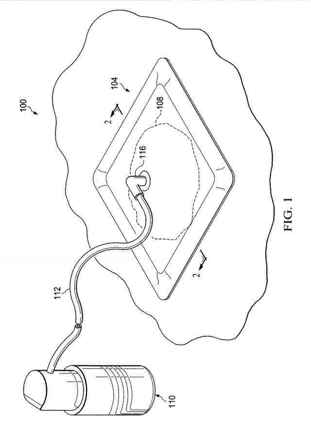 6037400-圧力調整機能を有する手動減圧ポンプ 図000002