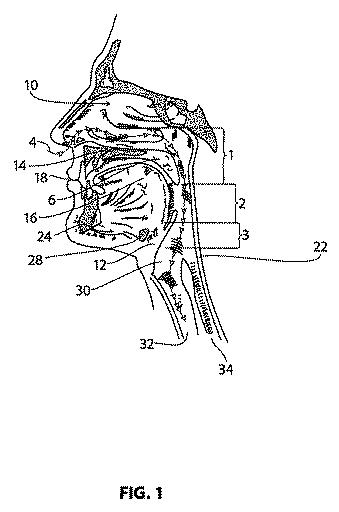 6057889-睡眠時無呼吸の治療システム及び方法 図000002