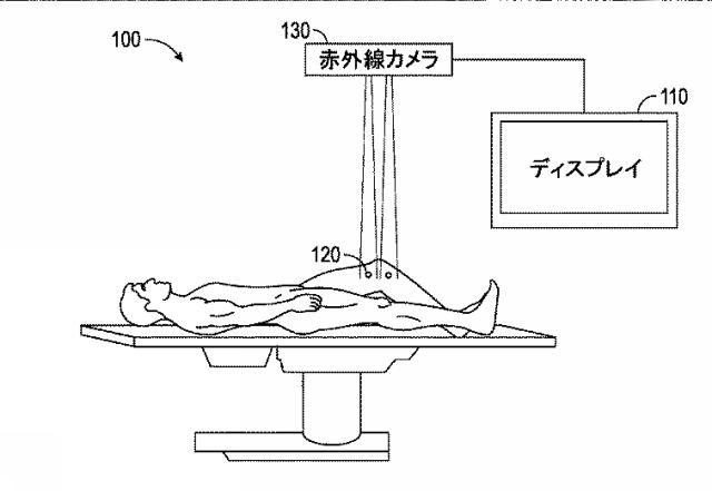 6151429-関節プロテーゼを配置する位置を判断するためのシステム及び方法 図000002