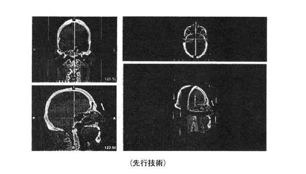 6396310-第一レンダリング投影と第二レンダリング投影との間のトランジションをユーザーに表示するための方法および装置 図000002