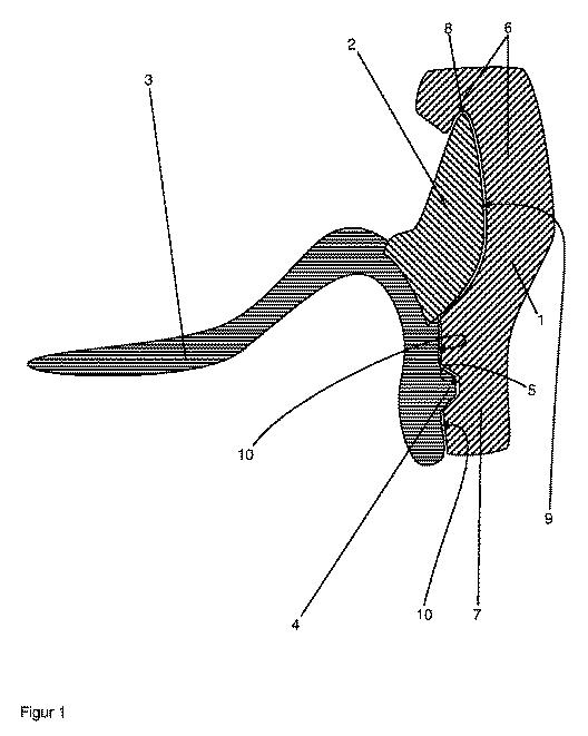 6429218-テンプレートを用いて歯科用補綴物を作製する方法 図000002