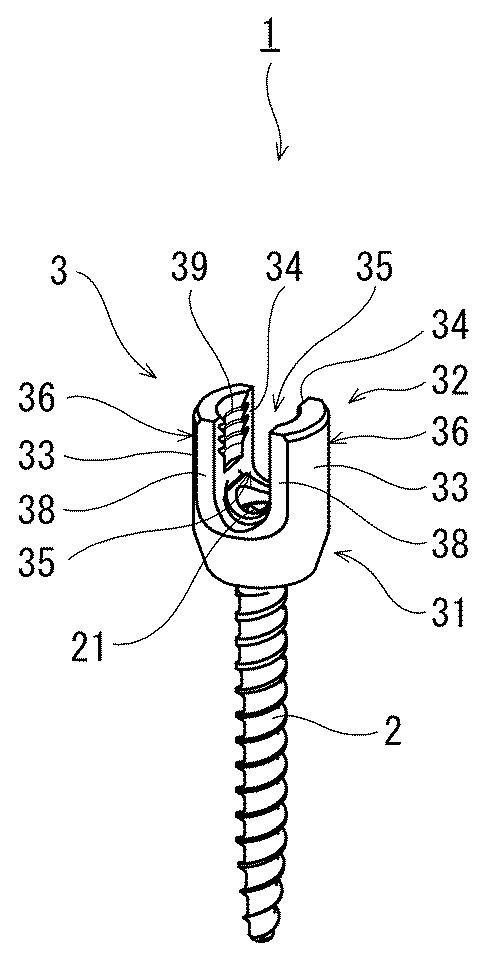 6662891-脊椎固定用保持具およびそれを備えた脊椎固定システム 図000002