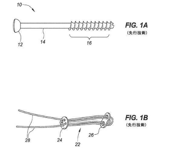 6707093-有効張力骨および関節安定化デバイス 図000002