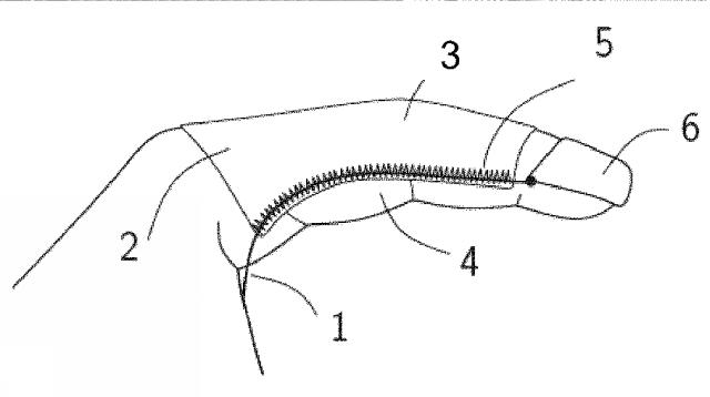 6717851-人口腱の取付け方法および製品 図000002