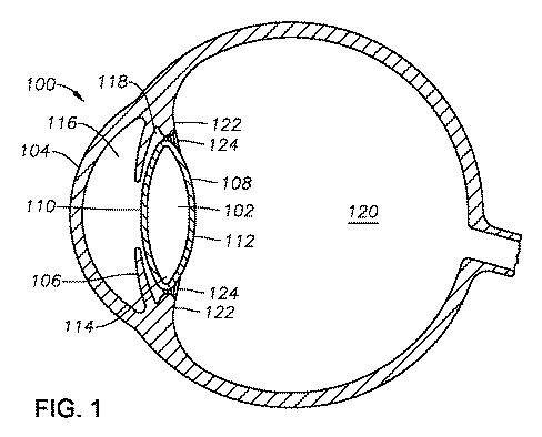 6781245-嚢混濁を抑制する水晶体嚢リングを有する眼内レンズ 図000002