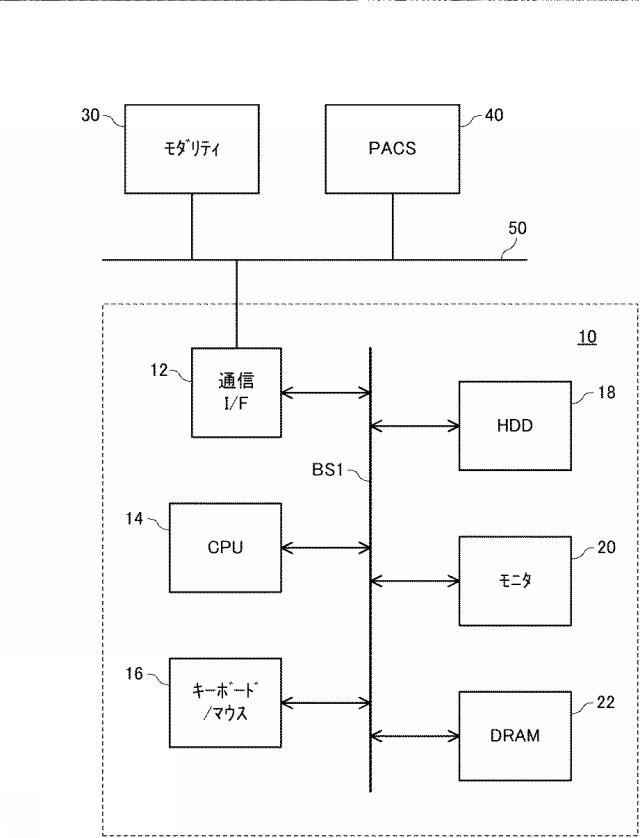 6859572-医用画像表示装置、医用画像表示方法、および医用画像表示プログラム 図000002