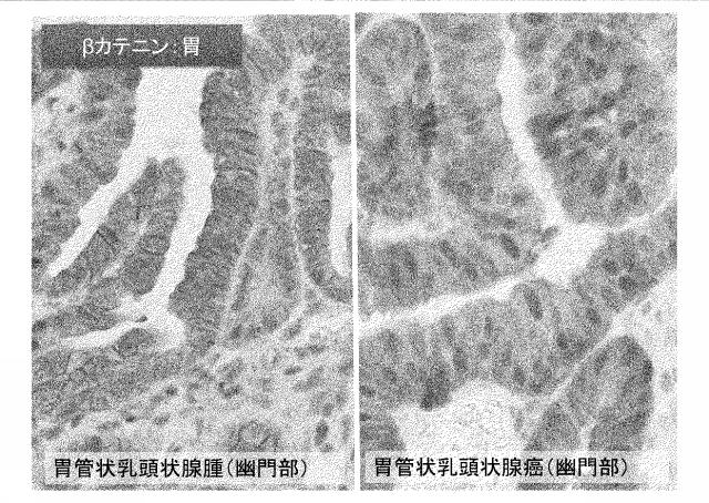 6963271-イヌの遺伝性消化管腫瘍症の遺伝子診断法 図000002