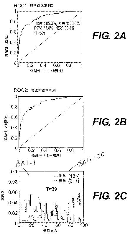 5717651-脳機能の確率的客観的査定のための方法および装置 図000003