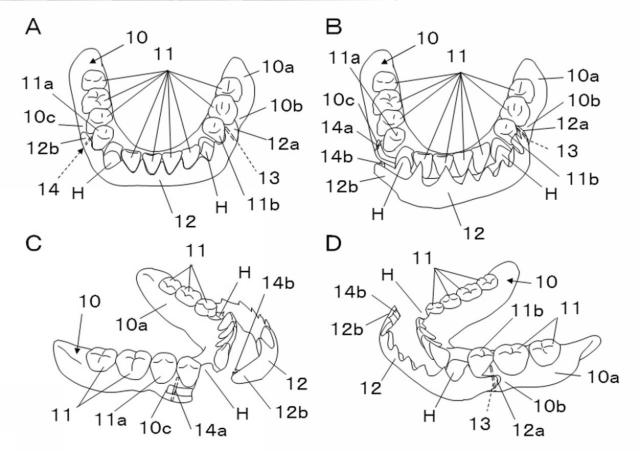 5720012-入れ歯 図000003