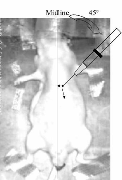 5787430-高骨転移性前立腺がん細胞株の作製方法 図000003