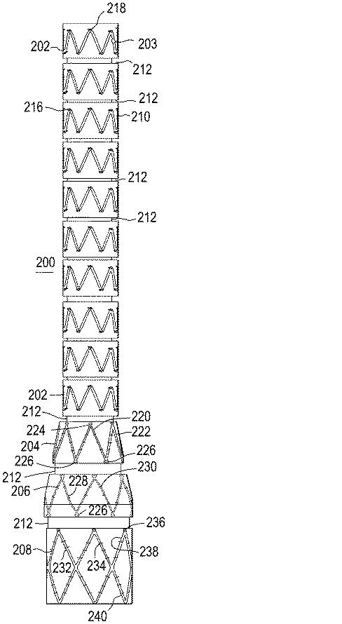 5823110-ステントグラフトの縫合糸のロック 図000003