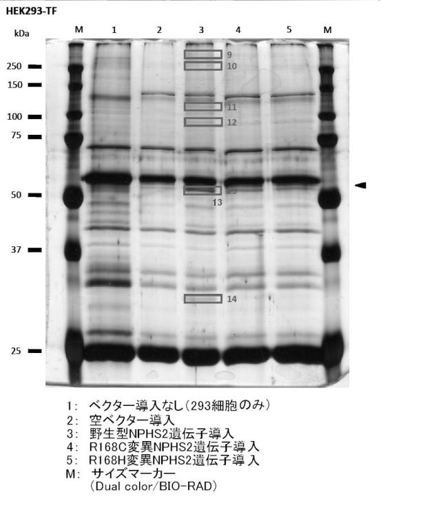 5830329-腎障害の新規マーカー 図000003