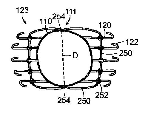 5872692-人工治療装置 図000003