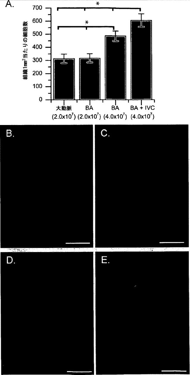 5931878-移植可能性の改良のための組織または器官の再細胞化法 図000003