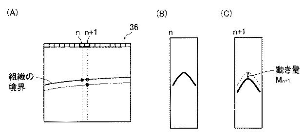 6047041-超音波診断装置、超音波診断装置の信号処理方法およびプログラム 図000003