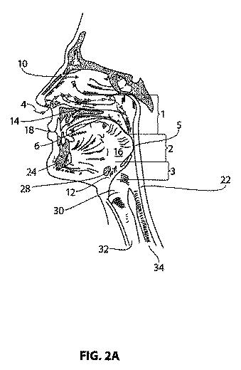 6057889-睡眠時無呼吸の治療システム及び方法 図000003