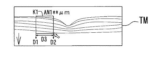 6241040-眼科解析装置、及び眼科解析プログラム 図000003