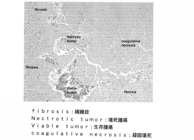 6278597-腫瘍の一掃のための方法および組成物 図000003