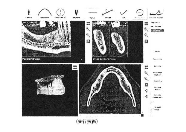 6396310-第一レンダリング投影と第二レンダリング投影との間のトランジションをユーザーに表示するための方法および装置 図000003