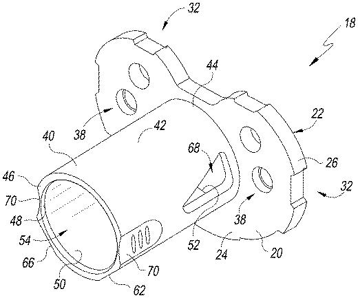 6433665-オフセットを設定するための脛骨の整形外科用手術器具 図000003