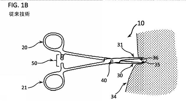 6580038-軟組織切開するための方法及び装置 図000003