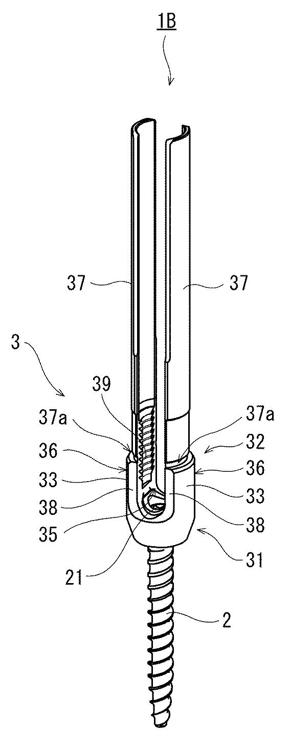 6662891-脊椎固定用保持具およびそれを備えた脊椎固定システム 図000003